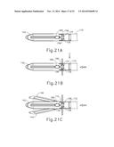 SURGICAL INSTRUMENT WITH SPLIT JAW diagram and image