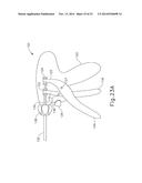 SURGICAL INSTRUMENT WITH SPLIT JAW diagram and image