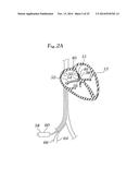 EXPANDABLE CLIP FOR TISSUE REPAIR diagram and image