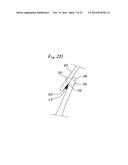 EXPANDABLE CLIP FOR TISSUE REPAIR diagram and image