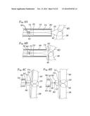 EXPANDABLE CLIP FOR TISSUE REPAIR diagram and image