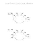 EXPANDABLE CLIP FOR TISSUE REPAIR diagram and image