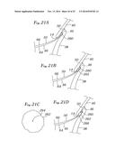 EXPANDABLE CLIP FOR TISSUE REPAIR diagram and image