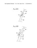 EXPANDABLE CLIP FOR TISSUE REPAIR diagram and image