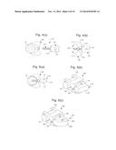 SEGMENTAL ORTHOPEDIC DEVICE FOR SPINAL ELONGATION AND FOR TREATMENT OF     SCOLIOSIS diagram and image