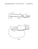 MEDICAL SPRING DEPLOYMENT DEVICE AND INSERTION TOOL diagram and image