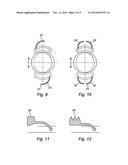 Accommodating Intraocular Lens with Haptics for Sulcus Fixation diagram and image