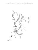 SYSTEMS FOR AND METHODS OF FUSING A SACROILIAC JOINT diagram and image