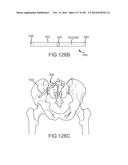 SYSTEMS FOR AND METHODS OF FUSING A SACROILIAC JOINT diagram and image