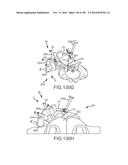 SYSTEMS FOR AND METHODS OF FUSING A SACROILIAC JOINT diagram and image