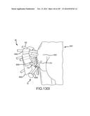 SYSTEMS FOR AND METHODS OF FUSING A SACROILIAC JOINT diagram and image