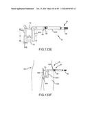 SYSTEMS FOR AND METHODS OF FUSING A SACROILIAC JOINT diagram and image