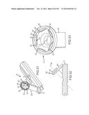 SYSTEMS FOR AND METHODS OF FUSING A SACROILIAC JOINT diagram and image