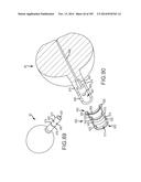 SYSTEMS FOR AND METHODS OF FUSING A SACROILIAC JOINT diagram and image