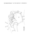 SYSTEMS FOR AND METHODS OF FUSING A SACROILIAC JOINT diagram and image