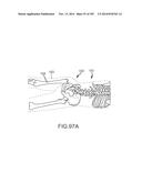 SYSTEMS FOR AND METHODS OF FUSING A SACROILIAC JOINT diagram and image