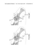 SYSTEMS FOR AND METHODS OF FUSING A SACROILIAC JOINT diagram and image