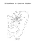 SYSTEMS FOR AND METHODS OF FUSING A SACROILIAC JOINT diagram and image