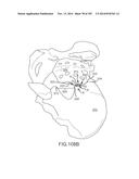 SYSTEMS FOR AND METHODS OF FUSING A SACROILIAC JOINT diagram and image