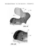 Patient Selectable Knee Arthroplasty Devices diagram and image