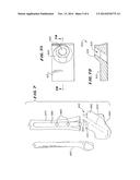 ANKLE REPLACEMENT SYSTEM diagram and image