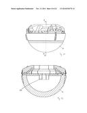 MEDICAL IMPLANT, INSTRUMENT HEAD AND ASSEMBLY diagram and image