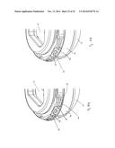 MEDICAL IMPLANT, INSTRUMENT HEAD AND ASSEMBLY diagram and image