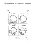 Analyzing High Dimensional Single Cell Data Using the T-Distributed     Stochastic Neighbor Embedding Algorithm diagram and image