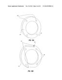 REFACING TOOLS AND METHODS diagram and image