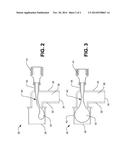 Bellows Bulb Occlusion Valve diagram and image