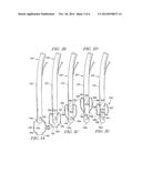 Welded Cuff diagram and image