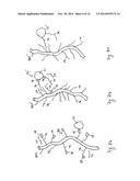 MINERAL SEPARATION USING FUNCTIONALIZED POLYMER OR POLYMER-COATED FILTERS     AND MEMBRANES diagram and image