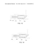 OPTICAL COHERENCE TOMOGRAPHY OPTICAL PROBE SYSTEMS AND METHODS TO REDUCE     ARTIFACTS diagram and image