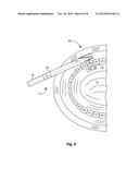 X-RAY TUBE AND RECEIVER INSIDE MOUTH diagram and image