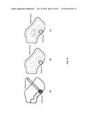 SYSTEM AND METHODS OF PHOTON-BASED RADIOTHERAPY AND RADIOSURGERY DELIVERY diagram and image