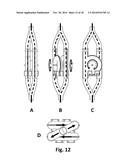 DOUBLE IMPULSE TURBINE SYSTEM diagram and image