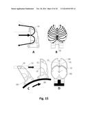 DOUBLE IMPULSE TURBINE SYSTEM diagram and image