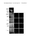 PROVASOPRESSIN ANTAGONISTS AND USES THEREOF diagram and image