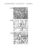 PROVASOPRESSIN ANTAGONISTS AND USES THEREOF diagram and image