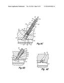 SUPERABSORBENT, FREEZE DRIED HYDROGELS FOR MEDICAL APPLICATIONS diagram and image