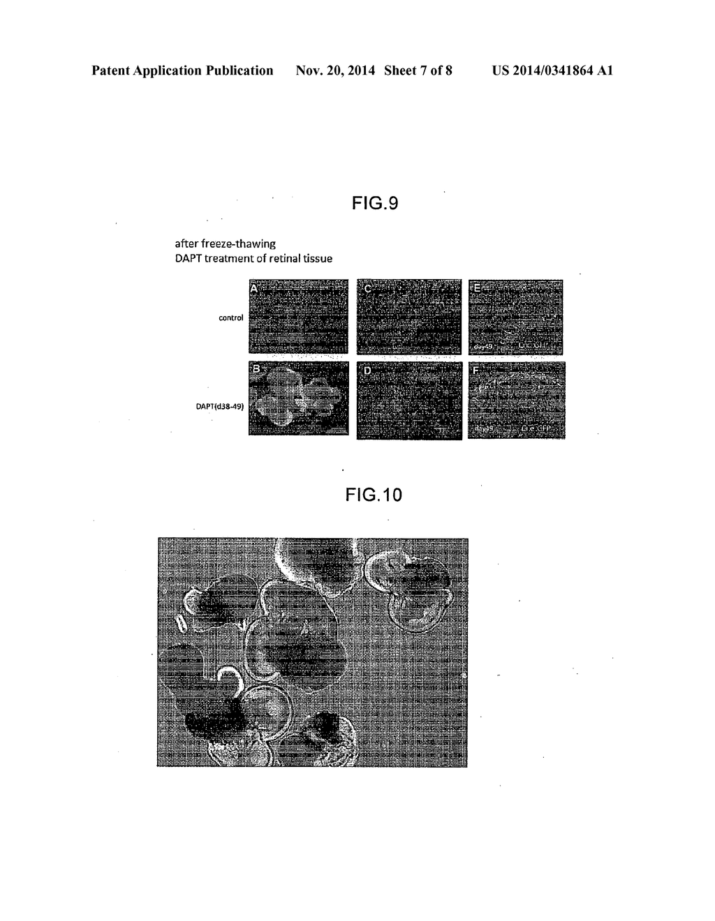 METHODS FOR PRODUCING RETINAL TISSUE AND RETINA-RELATED CELL - diagram, schematic, and image 08