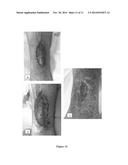 REGENERATIVE TISSUE MATRIX diagram and image