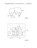 METHOD AND SYSTEM FOR PROVIDING FEEDBACK DATA USEFUL IN PROTHODONTIC     PROCEDURES ASSOCIATED WITH THE INTRA ORAL CAVITY diagram and image