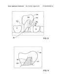 METHOD AND SYSTEM FOR PROVIDING FEEDBACK DATA USEFUL IN PROTHODONTIC     PROCEDURES ASSOCIATED WITH THE INTRA ORAL CAVITY diagram and image