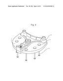 POSITIONING JIG AND IMPROVED METHODS TO DESIGN AND MANUFACTURE DENTAL     IMPLANTS diagram and image