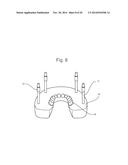 POSITIONING JIG AND IMPROVED METHODS TO DESIGN AND MANUFACTURE DENTAL     IMPLANTS diagram and image