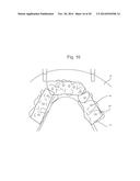 POSITIONING JIG AND IMPROVED METHODS TO DESIGN AND MANUFACTURE DENTAL     IMPLANTS diagram and image