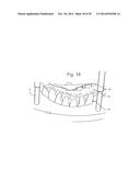 POSITIONING JIG AND IMPROVED METHODS TO DESIGN AND MANUFACTURE DENTAL     IMPLANTS diagram and image