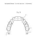 POSITIONING JIG AND IMPROVED METHODS TO DESIGN AND MANUFACTURE DENTAL     IMPLANTS diagram and image