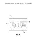 Device and Method for Treating Oral Pigmentation diagram and image